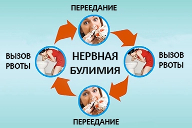 Лечение булимии в Краснообске